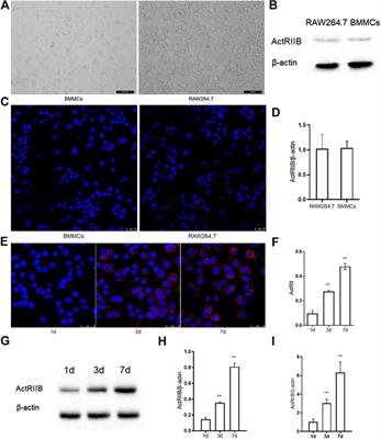 Myostatin Promotes Osteoclastogenesis by Regulating Ccdc50 Gene Expression and RANKL-Induced NF-κB and MAPK Pathways